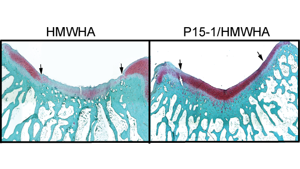 scan of cartilage tissue, both enflamed and un-enflamed.