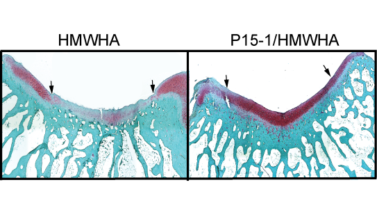 scan of cartilage tissue, both enflamed and un-enflamed.